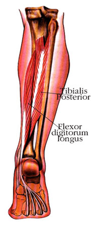 ISSA, International Sports Sciences Association, Certified Personal Trainer, Shoes, Could Your Shoes Be Giving You Shin Splints?